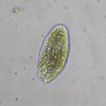 Protozoa 