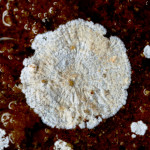 Actinomycetes